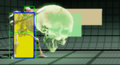 Spinal 236P-0Shb.png